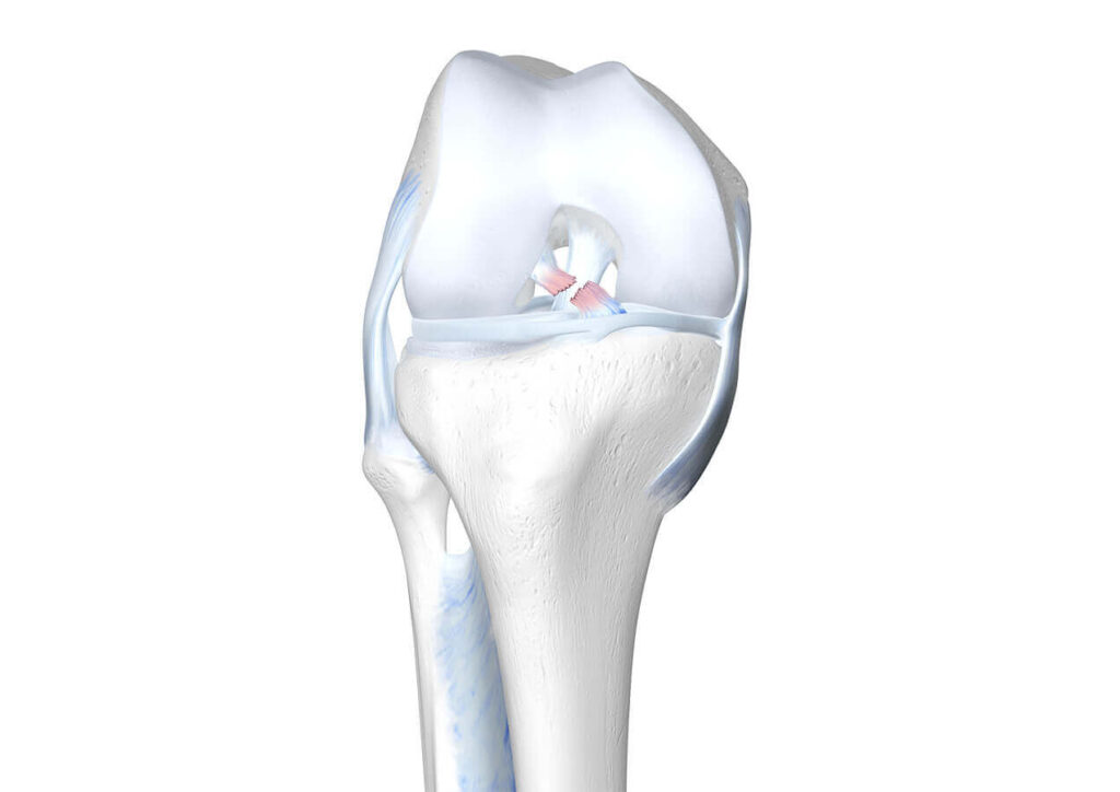 Anatomia del ginocchio con lesione del legamento crociato anteriore - Studio Fisioterapico Bertaina, Margarita (Cuneo)